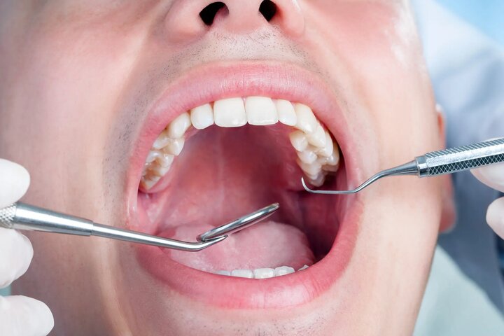 تشخیص سرطان و باکتری از طریق بزاق دهان در ۳۰ دقیقه با فناوری کریسپر
