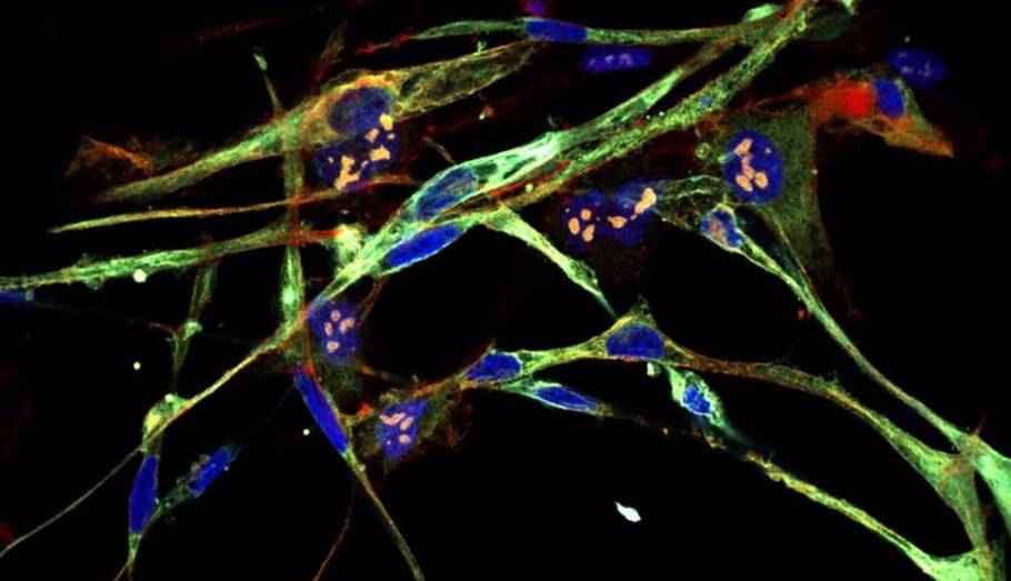 کشف روش تبدیل سلول‌های سرطانی به سلول‌های سالم بدن
