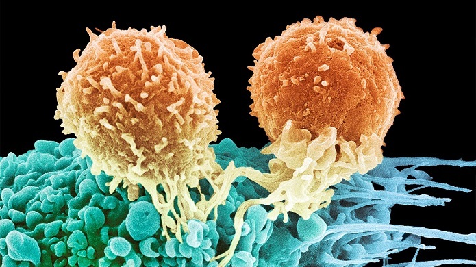 انتشار نتایج مثبت داروی ضدسرطانی که حاوی نانوذرات حامل mRNA است
