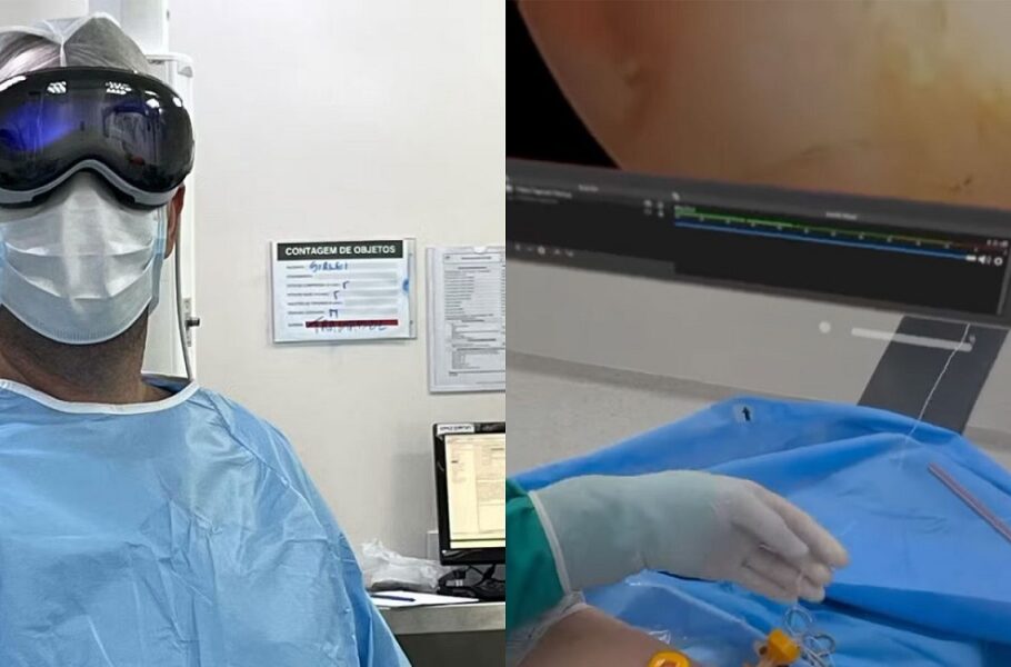 استفاده از اپل ویژن پرو برای جراحی آرتروسکوپی شانه