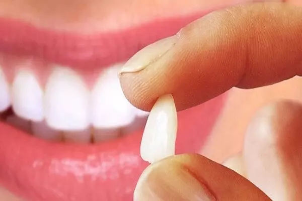 یک داروی جدید رشد دندان های تازه را در انسان ممکن می کند

