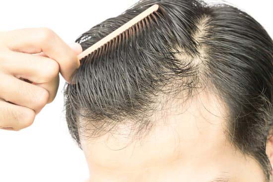 این ویتامین‌ ریزش مو را قطع و موهایتان را تقویت می‌کند!
