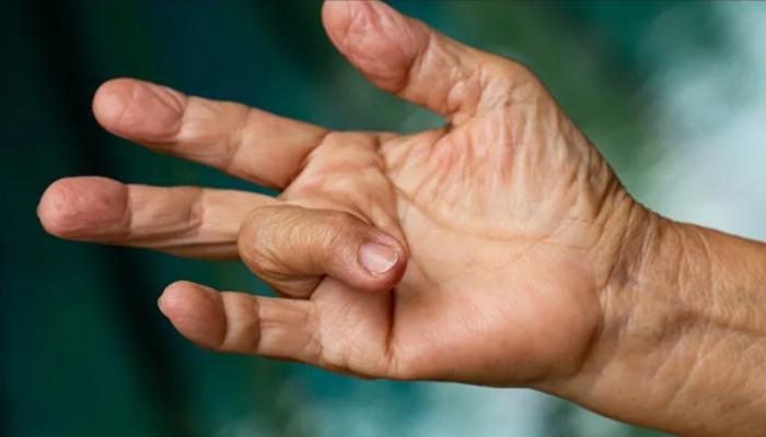دلیل قفل‌شدن انگشتان چیست؟
